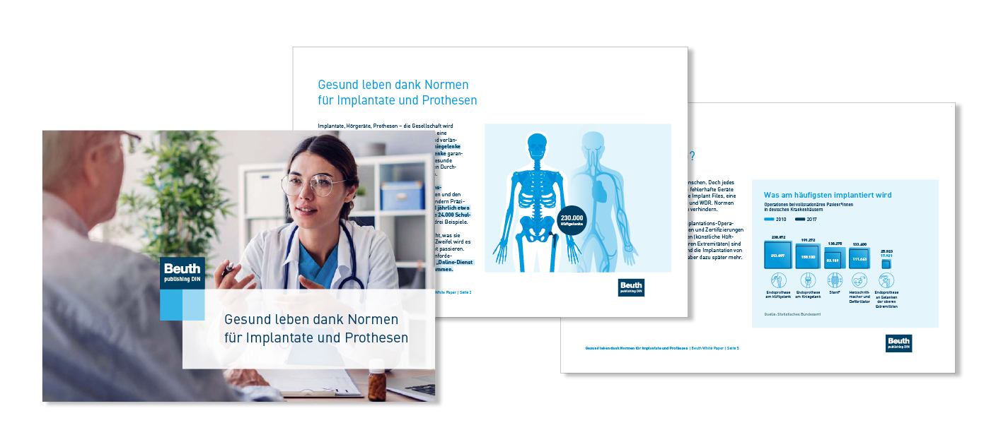 White-Paper über Normen für Implantate und Prothesen, mit Fokus auf gesundes Leben und häufige Implantationen.